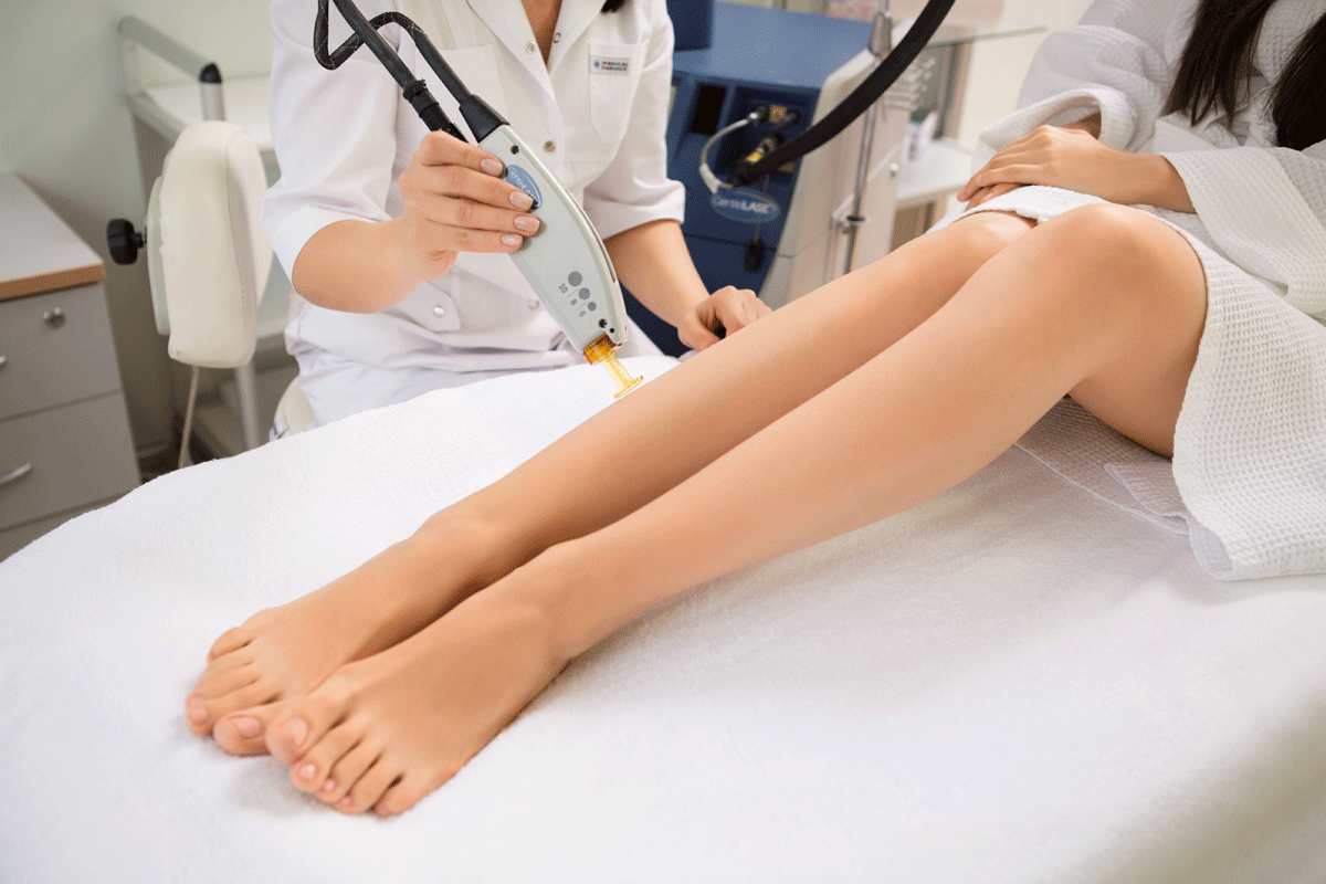 epilation-gentle-lase-2